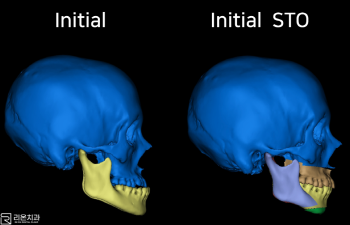 %255B%25EB%25A6%25AC%255D88.png